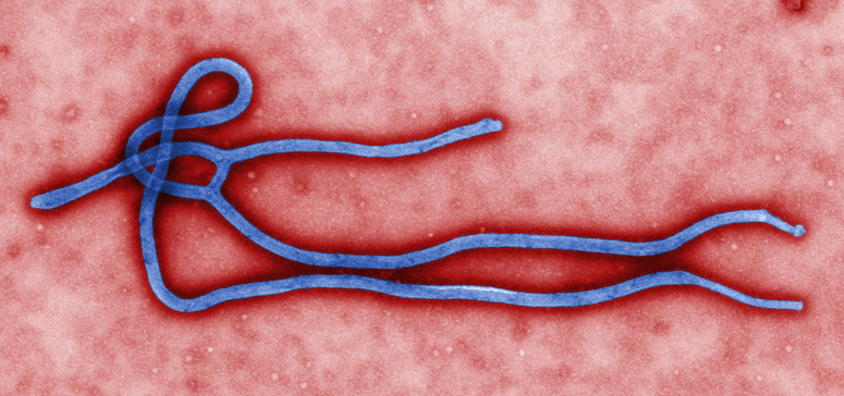 Allaying Your Ebola Fears